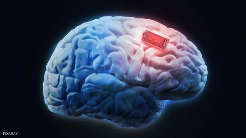 brain chip شريحة مزروعة بالدماغ تترجم أفكار رجل مشلول وتحولها إلى نص