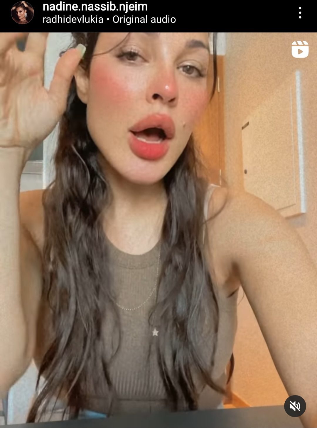وجه نادين نجيم يثير الجدل