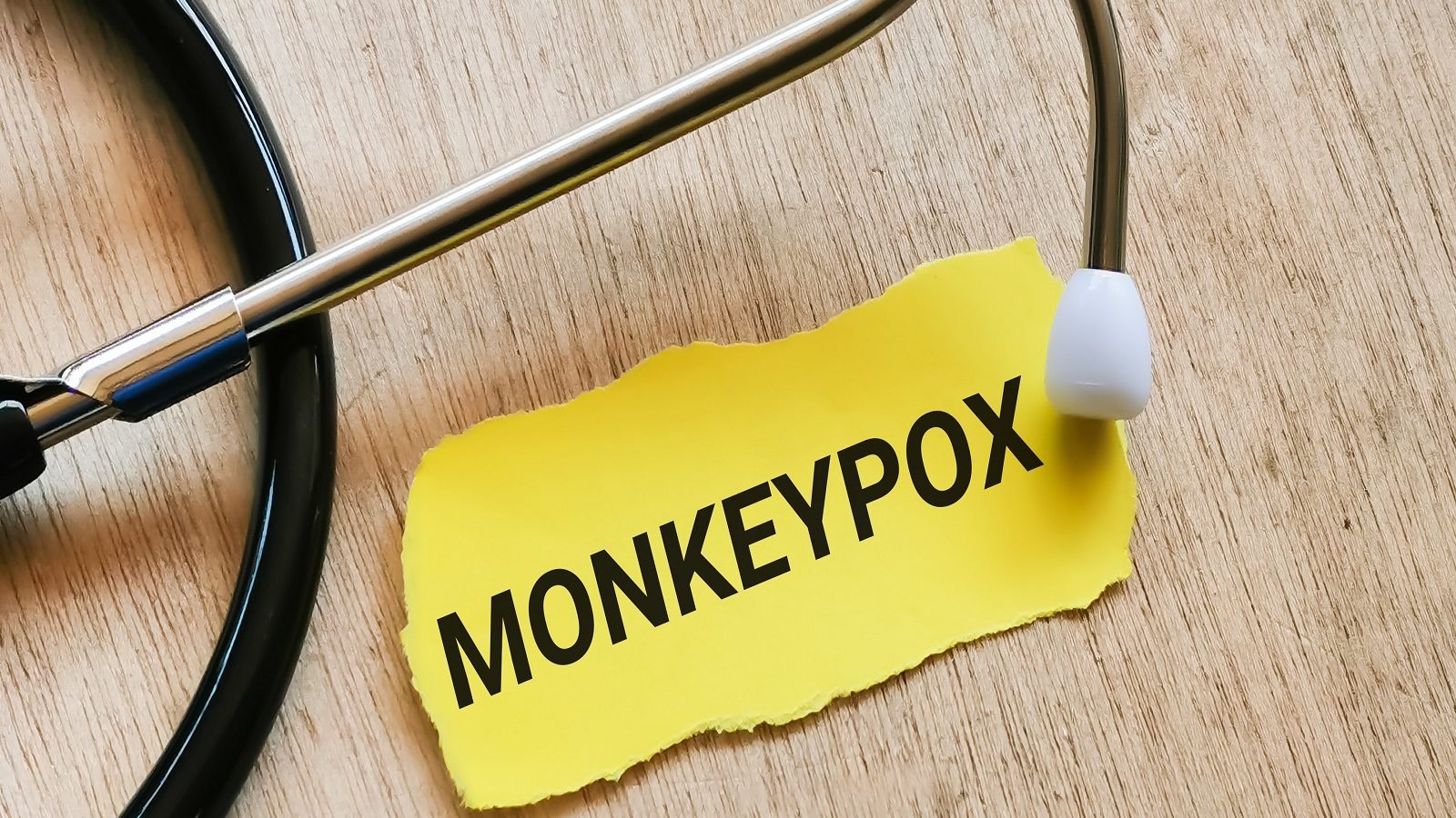 الكونغو سجّلت أعلى نسبة اصابات ووفيات بجدري القرود
