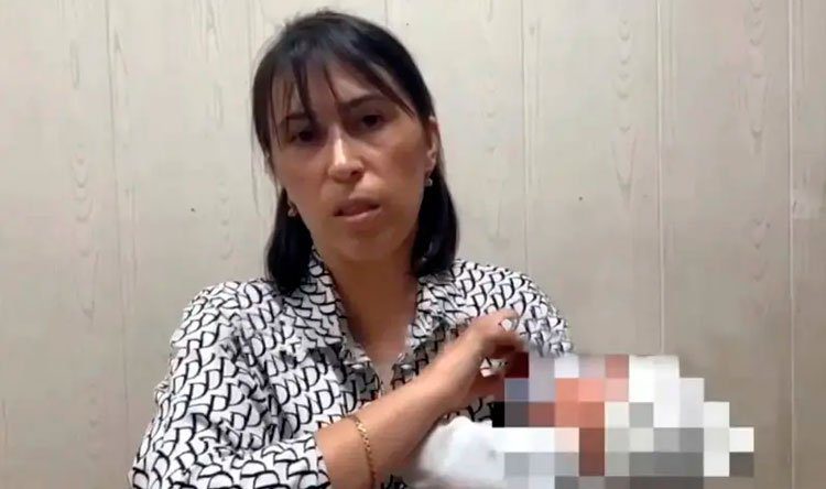 mother باعت رضيعها بـ3600$ لتجميل أنفها!!