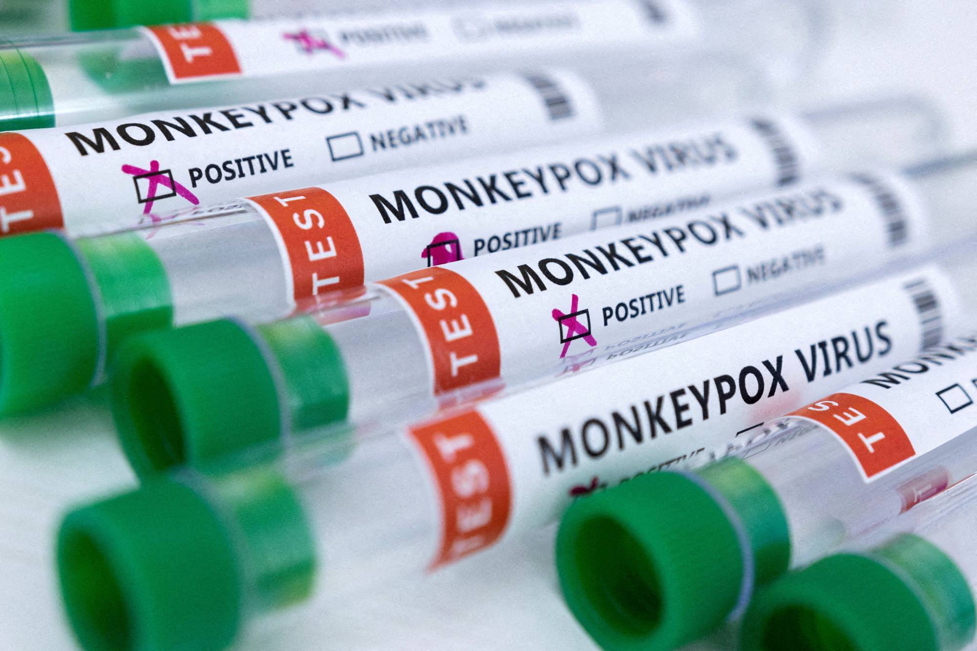 FILE PHOTO: Illustration shows test tubes labelled “Monkeypox virus positive and negative الولايات المتحدة.. تأكيد أول حالة وفاة بجدري القردة