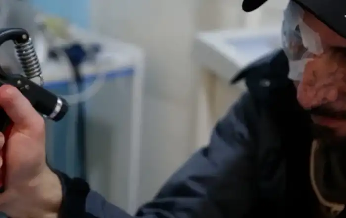 وجوه مشرعة بالجروح... الذكرى الأولى لتفجير البيجر: ألم وصبر وزواج وأحلام تنتظر